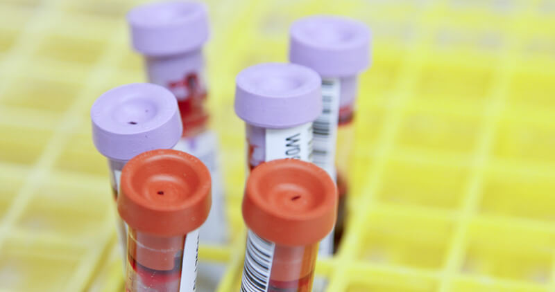 Immagine Piastrine e Sangue